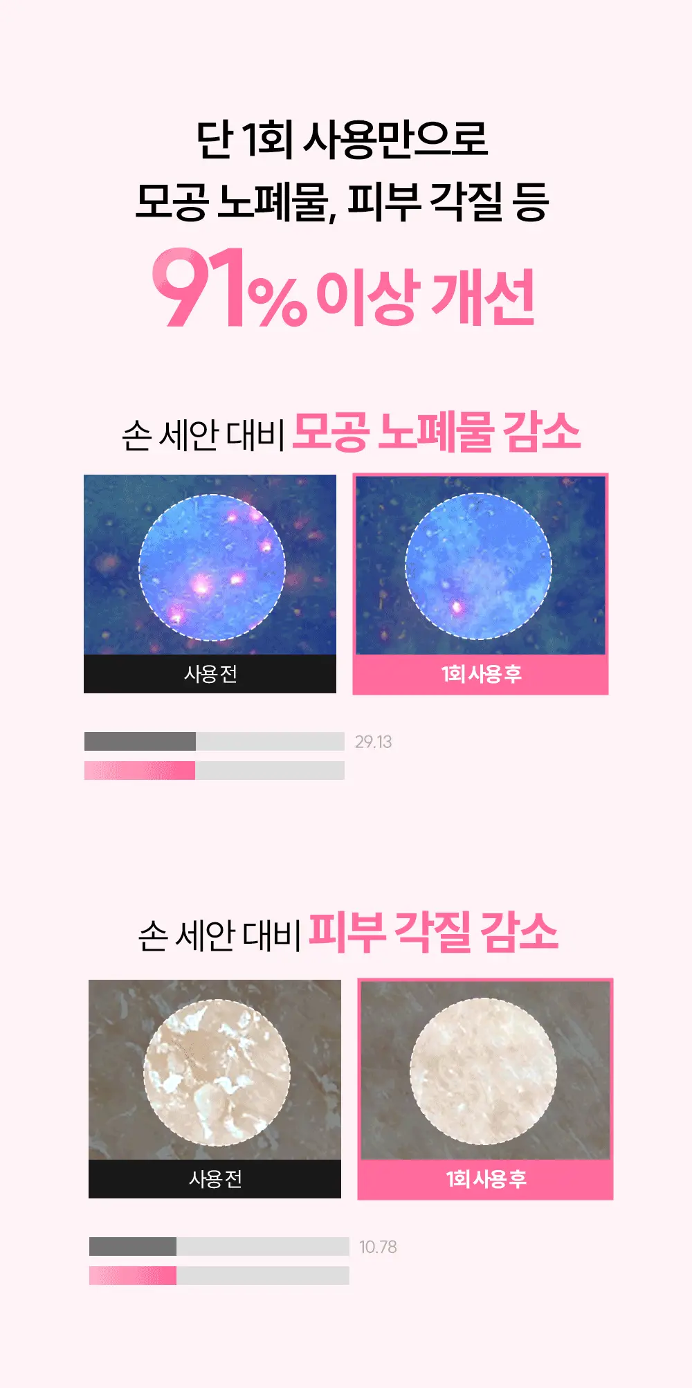 [품절대란] 멜리언스 진동클렌저 5종 택1 (거치대/충전기 포함) 상세페이지 18
